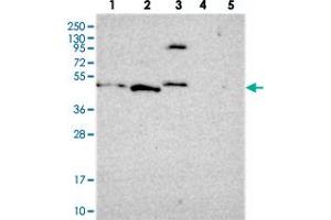 Western blot analysis of Lane 1: RT-4, Lane 2: U-251 MG, Lane 3: Human Plasma, Lane 4: Liver, Lane 5: Tonsil with FBRS polyclonal antibody  at 1:250-1:500 dilution. (Fibrosin 抗体)