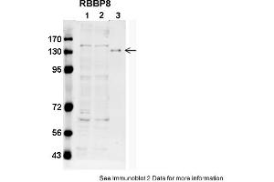 Sample type: 1. (Retinoblastoma Binding Protein 8 抗体  (C-Term))
