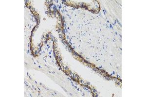 Immunohistochemistry of paraffin-embedded human prostate using  antibody (ABIN1512611, ABIN3021021, ABIN3021022, ABIN1513797 and ABIN6213916) at dilution of 1:100 (40x lens). (ATP1A (AA 551-850) 抗体)