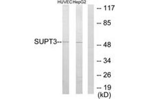 Western Blotting (WB) image for anti-Suppressor of Ty 3 Homolog (SUPT3H) (AA 171-220) antibody (ABIN2889347) (SUPT3H/SPT3 抗体  (AA 171-220))