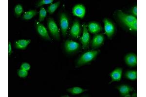 Immunofluorescence staining of A549 cells with ABIN7149579 at 1:66, counter-stained with DAPI. (DOCK1 抗体  (AA 1676-1865))