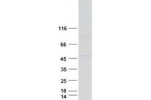 Western Blotting (WB) image for Beaded Filament Structural Protein 2, Phakinin (BFSP2) protein (Myc-DYKDDDDK Tag) (ABIN2728812)