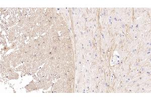 Detection of CDNF in Rat Spinal cord Tissue using Monoclonal Antibody to Cerebral Dopamine Neurotrophic Factor (CDNF) (CDNF 抗体  (AA 20-183))