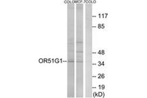 Western blot analysis of extracts from COLO/MCF-7 cells, using OR51G1 Antibody. (OR51G1 抗体  (AA 199-248))