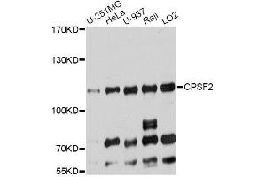 Western blot analysis of extracts of various cell lines, using CPSF2 antibody (ABIN5996261) at 1:7000 dilution. (CPSF2 抗体)