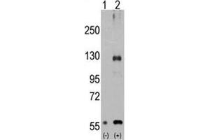 Western blot analysis of TRPM8 antibody and 293 cell lysate either nontransfected (Lane 1) or transiently transfected with the TRPM8 gene (2). (TRPM8 抗体  (AA 521-552))