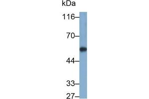 Detection of CYP1A1 in Rat Liver lysate using Polyclonal Antibody to Cytochrome P450 1A1 (CYP1A1) (CYP1A1 抗体  (AA 251-521))