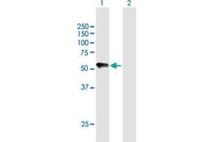 Western Blot analysis of CHRDL2 expression in transfected 293T cell line by CHRDL2 MaxPab polyclonal antibody. (CHRDL2 抗体  (AA 1-451))