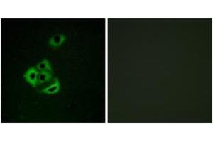 Immunofluorescence analysis of A549 cells, using MCL1 (Phospho-Ser159) Antibody. (MCL-1 抗体  (pSer159))