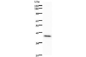 Western Blotting (WB) image for anti-Peroxisome Proliferator-Activated Receptor alpha (PPARA) antibody (ABIN931197) (PPARA 抗体)