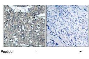 Image no. 1 for anti-Paxillin (PXN) (Tyr118) antibody (ABIN197279) (Paxillin 抗体  (Tyr118))