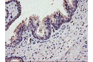 Image no. 2 for anti-Diacylglycerol Kinase, alpha 80kDa (DGKA) antibody (ABIN1497815) (DGKA 抗体)