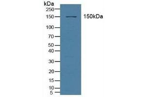 Western Blotting (WB) image for anti-ATP-Binding Cassette, Sub-Family C (CFTR/MRP), Member 3 (ABCC3) (AA 1291-1523) antibody (ABIN7441079)