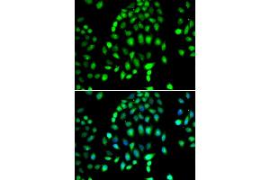 Immunofluorescence analysis of MCF-7 cells using PARP3 antibody (ABIN4904680). (PARP3 抗体)
