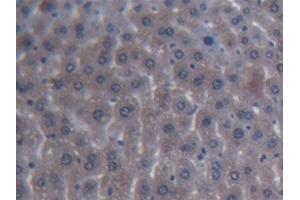 DAB staining on IHC-P; Samples: Mouse Liver Tissue (ITIH4 抗体  (AA 721-942))