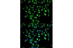 Immunofluorescence analysis of MCF-7 cell using CD86 antibody. (CD86 抗体  (AA 30-247))