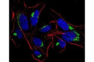 Immunofluorescence analysis of HeLa cells using HDAC4 mouse mAb (green). (HDAC4 抗体  (AA 456-592))