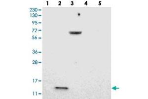 Western blot analysis of Lane 1: RT-4, Lane 2: U-251 MG, Lane 3: Human Plasma, Lane 4: Liver, Lane 5: Tonsil with LOC203547 polyclonal antibody . (VMA21 抗体)