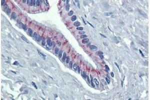 Pancreas, Human: Formalin-Fixed, Paraffin-Embedded (FFPE) (Desmoglein 2 抗体  (AA 72-121))