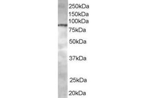 Western Blotting (WB) image for anti-ArfGAP with Coiled-Coil, Ankyrin Repeat and PH Domains 1 (ACAP1) (C-Term) antibody (ABIN2465343) (ACAP1 抗体  (C-Term))