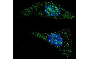 Fluorescent image of  cells stained with ATG5 (N-term) antibody. (ATG5 抗体  (N-Term))