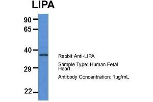 Host: Rabbit  Target Name: LIPA  Sample Tissue: Human Fetal Heart  Antibody Dilution: 1. (Lipase A 抗体  (N-Term))