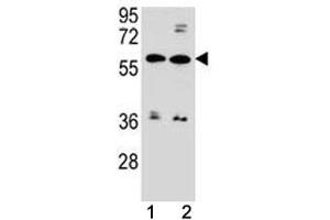 ABCG4 antibody western blot analysis in MDA-MB453, ZR-75-1 lysate. (ABCG4 抗体  (AA 36-65))