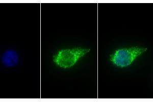 Detection of ALDH1B1 in Human HepG2 cell using Polyclonal Antibody to Aldehyde Dehydrogenase 1 Family, Member B1 (ALDH1B1) (ALDH1B1 抗体  (AA 18-517))
