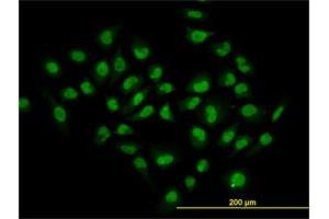 Immunofluorescence of monoclonal antibody to HDAC1 on HeLa cell. (HDAC1 抗体  (AA 1-482))