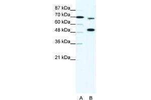 WB Suggested Anti-MLL4 Antibody Titration:  5ug/ml  Positive Control:  HepG2 cell lysate KMT2B is strongly supported by BioGPS gene expression data to be expressed in Human HepG2 cells (MLL4 抗体  (N-Term))