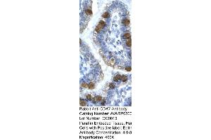 Human Intestine (CDK7 抗体  (C-Term))