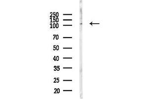 anti-Cbl Proto-Oncogene B, E3 Ubiquitin Protein Ligase (CBLB) (N-Term) antibody
