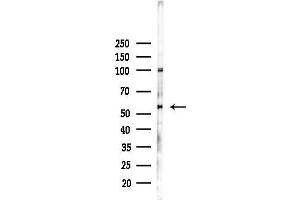 Western blot analysis of lysates from Hela cells(heat-shock,45 min treatment), using Phospho-Tau (Ser199)[Ser516] Antibody at 1/1000 dilution.