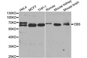 Western Blotting (WB) image for anti-Cystathionine-beta-Synthase (CBS) (AA 252-551) antibody (ABIN3021959)