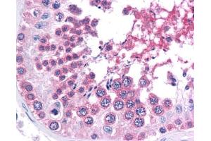 Immunohistochemistry (IHC) image for anti-SWI/SNF Related, Matrix Associated, Actin Dependent Regulator of Chromatin, Subfamily A, Member 4 (SMARCA4) (C-Term) antibody (ABIN2471066)