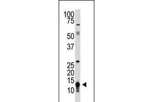 Antibody is used in Western blot to detect SUMO1 in HL-60 cell lysate. (D SUMO (AA 37-66), (C-Term) 抗体)