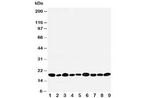 Western Blotting (WB) image for anti-Nucleoside diphosphate kinase B (NME2) (AA 137-152) antibody (ABIN3032112)
