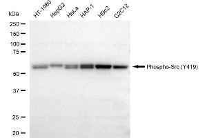Western blotting analysis using Phospho-Src (Y419) antibody (ABIN7800050). (Recombinant Src 抗体  (pTyr419))