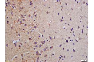 Formalin-fixed and paraffin embedded rat brain labeled with Anti-phospho-MBP(Thr232)Polyclonal Antibody, Unconjugated  at 1:200 followed by conjugation to the secondary antibody and DAB staining (MBP 抗体  (pThr232))