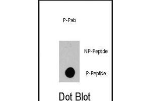Dot blot analysis of anti-BRAF-p Phospho-specific Pab (ABIN389803 and ABIN2839698) on nitrocellulose membrane. (BRAF 抗体  (pSer445))