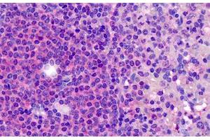 Human Tonsil: Formalin-Fixed, Paraffin-Embedded (FFPE) (CD180 抗体  (N-Term))