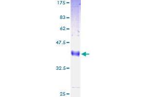 LY6H Protein (AA 26-140) (GST tag)