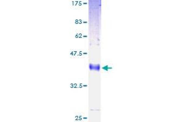 LY6H Protein (AA 26-140) (GST tag)