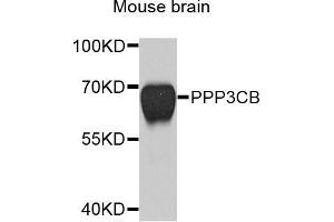 Western blot analysis of extracts of mouse brain, using PPP3CB antibody (ABIN5971879) at 1/1000 dilution. (PPP3CB 抗体)