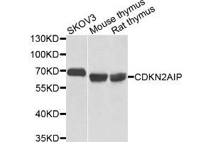 Western blot analysis of extracts of various cell lines, using CDKN2AIP antibody (ABIN5971664) at 1/1000 dilution. (CDKN2AIP 抗体)