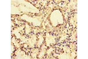 Immunohistochemistry of paraffin-embedded human lung tissue using ABIN7152273 at dilution of 1:100 (Exophilin 5 抗体  (AA 1235-1490))
