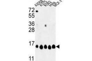 Western Blotting (WB) image for anti-Histone H2A Type 1-H (HIST1H2AH) antibody (ABIN3003926) (HIST1H2AH 抗体)