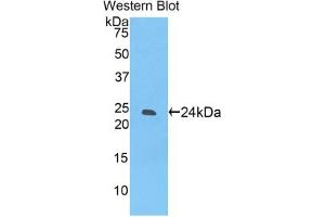 Western blot analysis of the recombinant protein. (SIGLEC12 抗体  (AA 22-218))