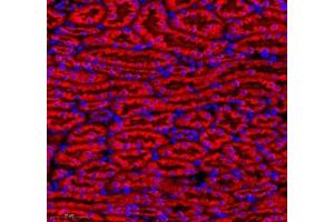 Immunofluorescence of paraffin embedded mouse kidney using MAP7 (ABIN7074621) at dilution of 1:400 (300x lens) (MAP7 抗体)