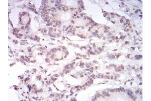 Immunohistochemistry (IHC) image for anti-Paired Box 6 (PAX6) (AA 1-122) antibody (ABIN5542664)